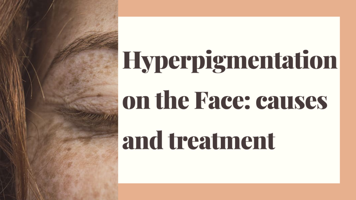 hyperpigmentation-on-the-face-feature