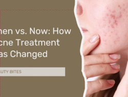 acne-treatment-featured