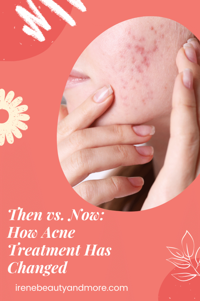 acne-treatment-pin