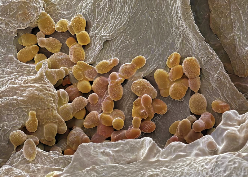 acne-treatment-bacteria
