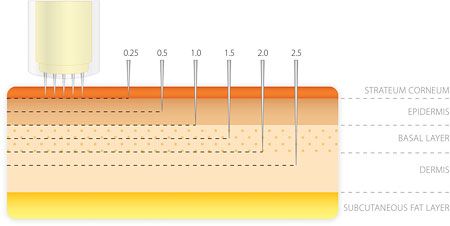 microneedling-needle-depth
