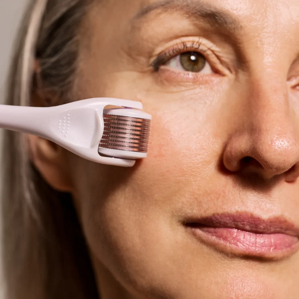 microneedling-dermaroller